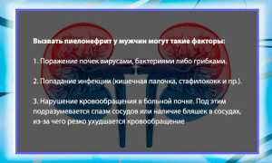 Симптомы пиелонефрита у мужчин