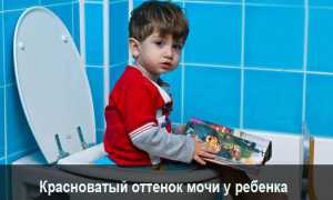 Причины красной мочи у ребенка