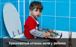Причины красной мочи у ребенка