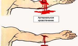 Особенности оказания пострадавшим первой помощи при кровотечениях