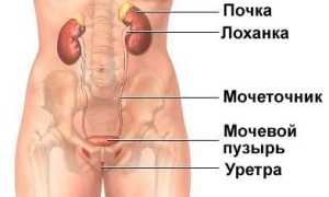 Воспаление мочеточника