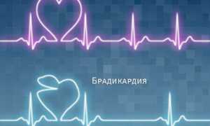 ЭКГ: описание процедуры и правильная расшифровка результатов