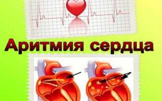 Эффективнейшие лекарства от аритмии