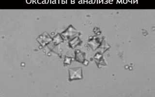 Оксалаты в моче