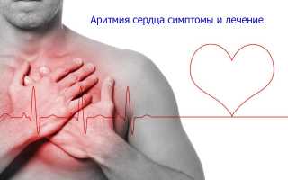Аритмия сердца: что это такое, симптомы и лечение