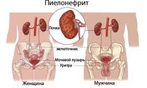 Стол питания при пиелонефрите