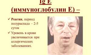 Анализ крови при аллергии