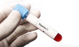Anti-HCV анализ крови: что это такое и для чего делать