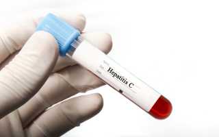 Anti-HCV анализ крови: что это такое и для чего делать